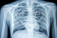 An x-ray of a human torso shows the ribcage and other bones, as well as a Superman logo.